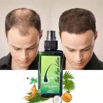 Neo Hair Grow Lotion